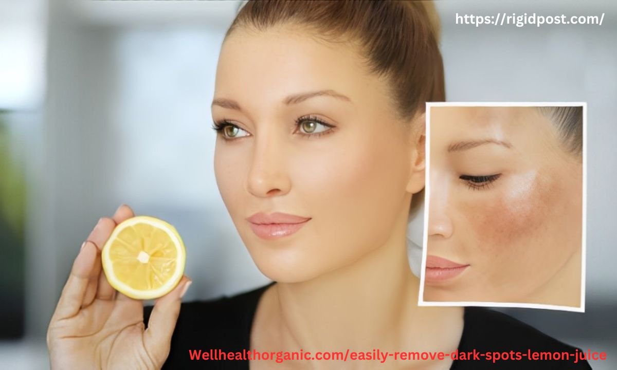 Wellhealthorganic.com/easily-remove-dark-spots-lemon-juice100% Scientific