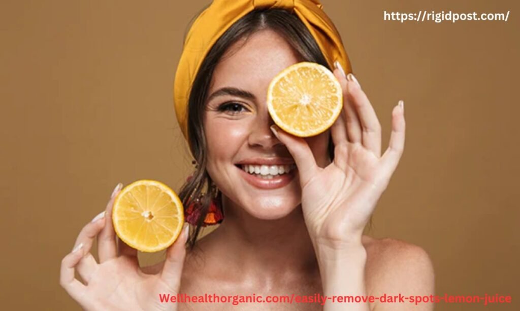 Wellhealthorganic.comeasily-remove-dark-spots-lemon-juice (1)